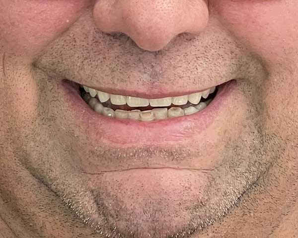 dopo